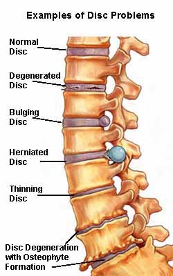 Chiropractic care near me for causes of lower back pain